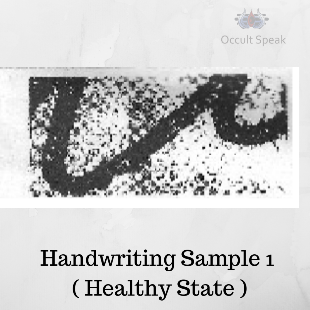 How to detect Early Stage Cancer by Handwriting?