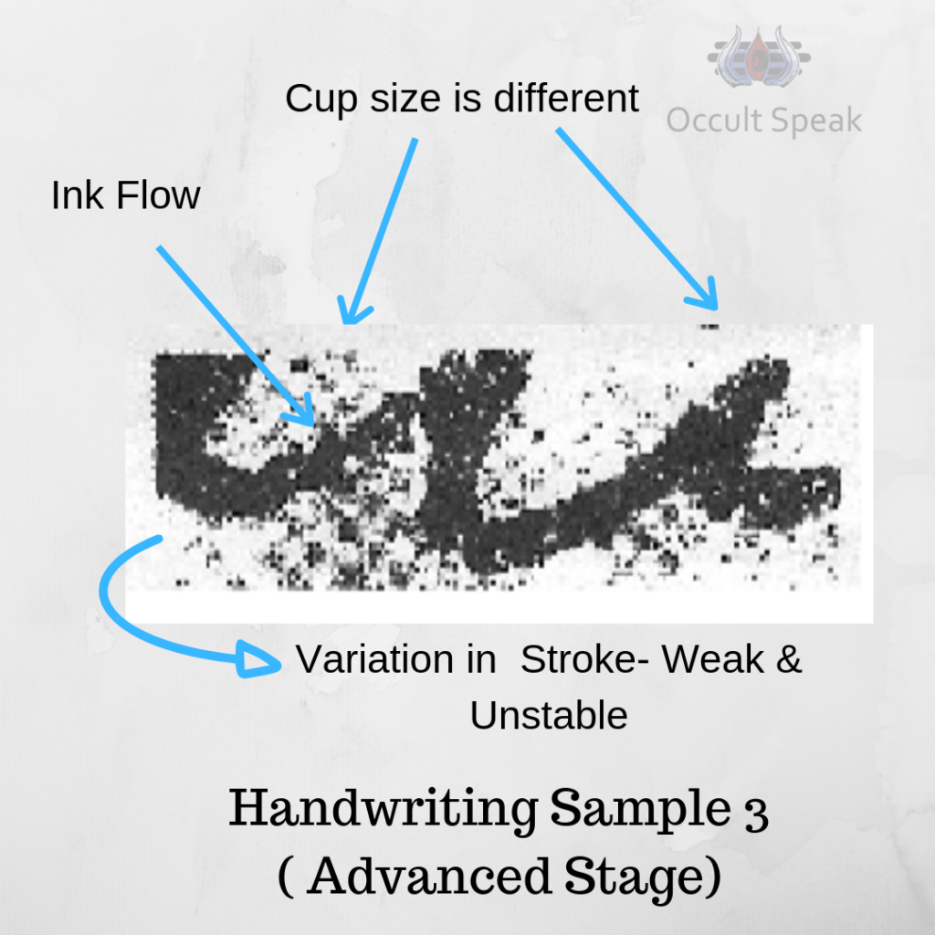 How to detect Early Stage Cancer by Handwriting?